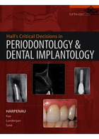 Hall's Critical Decisions in Periodontology | تصمیمات حیاتی هال در پریودنتولوژی