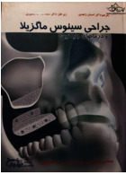 درمان سینوس ماگزیلا و درمان های جایگزین