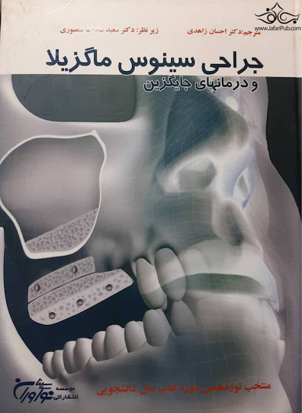 درمان سینوس ماگزیلا و درمان های جایگزین