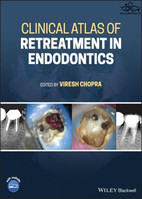 Clinical Atlas of Retreatment in Endodontics  John Wiley and Sons Ltd 