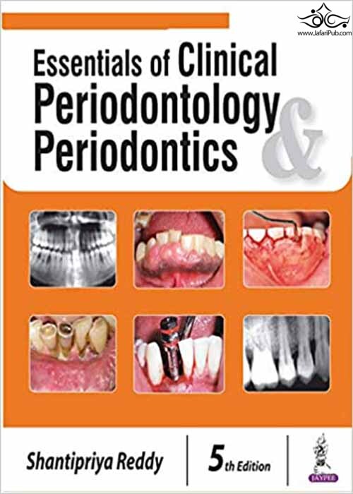Essentials of Clinical Periodontology and Periodontics 5th Edición  Jaypee Brothers Medical Publishers 