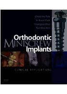 Orthodontic Miniscrew Implants : Clinical Applications | ایمپلنت های مینی اسکرو ارتودنسی