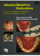 Adhesive Metal-Free Restorations : Current Concepts in the Aesthetic Treatment of Posterior Teeth | ترمیم های بدون فلز چسب