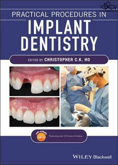 Practical Procedures in Implant Dentistry  John Wiley and Sons Ltd 