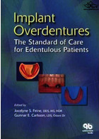 Implant Overdentures as the Standard of Care for Edentulous Patients | اوردنچر ایمپلنت به عنوان استاندارد مراقبت از بیماران بی دندان