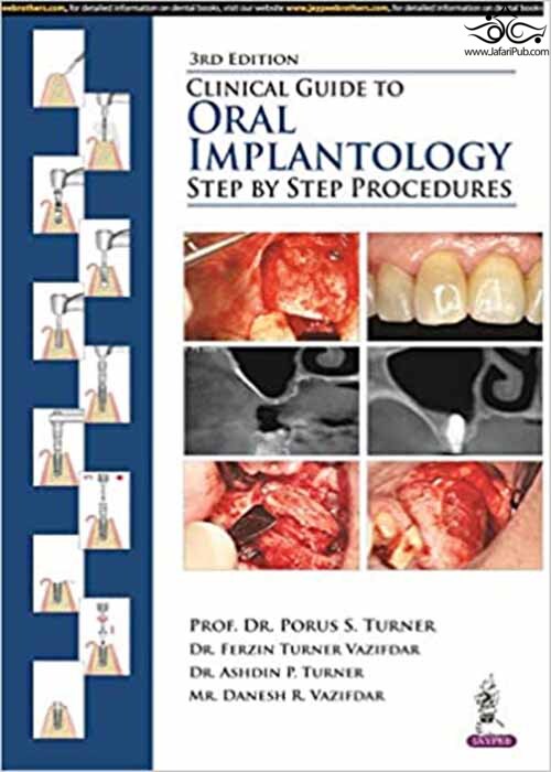 Clinical Guide to Oral Implantology: Step by Step Procedures 3rd Edición  Jaypee Brothers Medical Publishers 