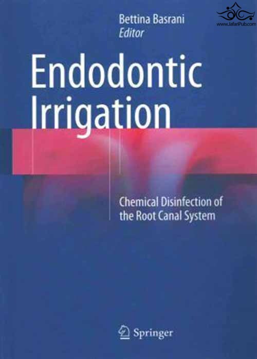 Endodontic Irrigation : Chemical disinfection of the root canal system Springer