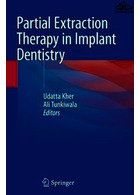 Partial Extraction Therapy in Implant Dentistry | درمان استخراج جزئی در دندانپزشکی ایمپلنت