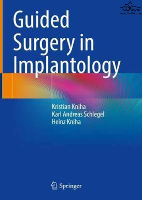 Guided Surgery in Implantology Springer