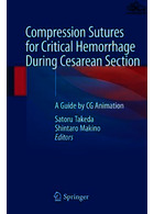 Compression Sutures for Critical Hemorrhage During Cesarean Section | بخیه های فشاری برای خونریزی بحرانی در طول سزارین