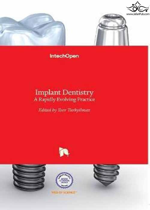 Implant Dentistry : A Rapidly Evolving Practice  In Tech 