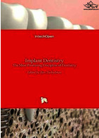 Implant Dentistry : The Most Promising Discipline of Dentistry | ایمپلنت دندانپزشکی