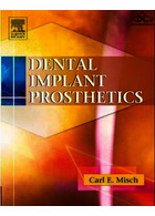 Dental Implant Prosthetics | پروتز ایمپلنت دندان