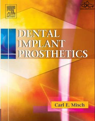 Dental Implant Prosthetics ELSEVIER