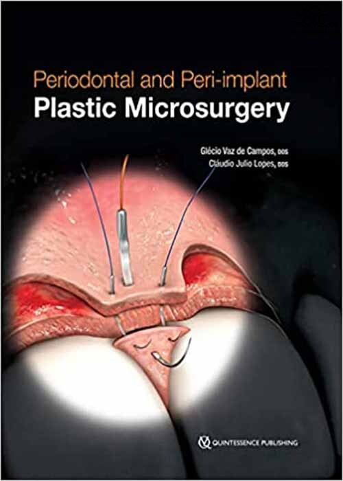 Periodontal and Peri-implant Plastic Microsurgery: Minimally Invasive Techniques with Maximum Precision  Quintessence Publishing Co Inc.,U.S
