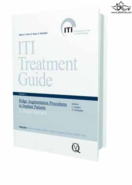 Ridge Augmentation Procedures in Implant Patients: A Staged Approach  Quintessence Publishing Co Inc.,U.S