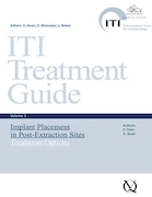 ITI Treatment Guide: Implant Placement in Post-extraction Sites: Treatment Options 3 | راهنمای درمان ITI: قرار دادن ایمپلنت در محل های پس از استخراج