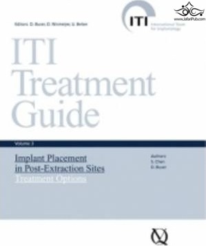 ITI Treatment Guide: Implant Placement in Post-extraction Sites: Treatment Options 3 Quintessenz Verlags GmbH