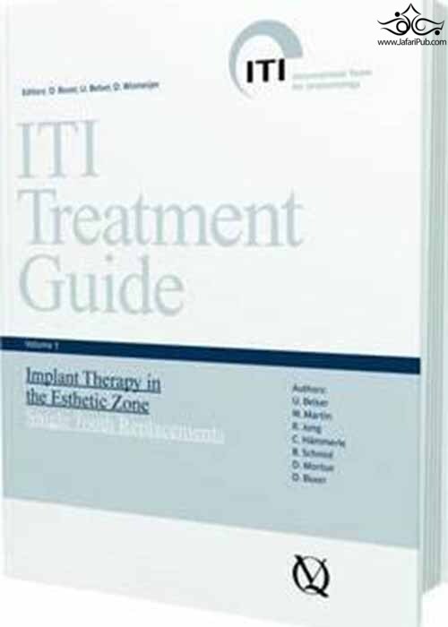 ITI Treatment Guide: Implant Therapy in the Esthetic Zone - Single-tooth Replacements v. 1 Quintessenz Verlags GmbH