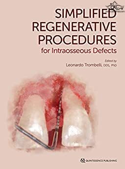 Simplified Regenerative Procedures for Intraosseous Defects  Quintessence Publishing Co Inc.,U.S