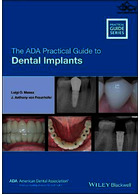 The ADA Practical Guide to Dental Implants 2021 | راهنمای عملی ADA برای ایمپلنت های دندانی