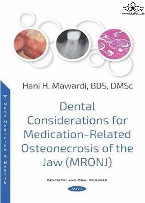 Dental Considerations for Medication-Related Osteonecrosis of the Jaw (MRONJ)  Nova Science Publishers Inc 