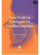 Bone Grafting Techniques for Maxillary Implants | تکنیک های پیوند استخوان برای ایمپلنت های فک بالا