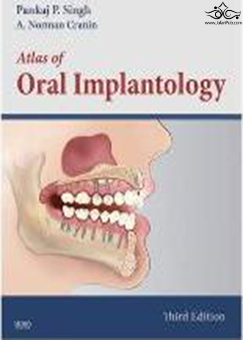 Atlas of Oral Implantology ELSEVIER