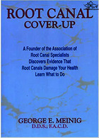 Root Canal Cover Up | پوشاندن کانال ریشه