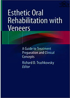 Esthetic Oral Rehabilitation with Veneers | توانبخشی زیبایی دهان با ونیر