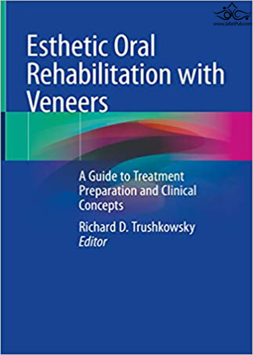 Esthetic Oral Rehabilitation with Veneers Springer