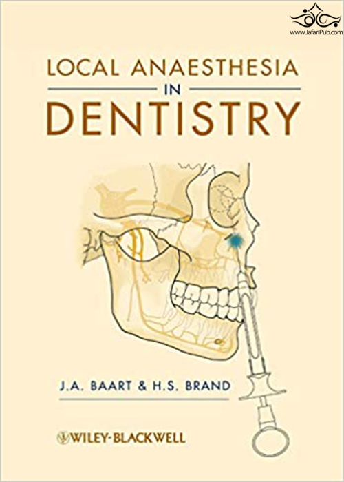 Local Anaesthesia in Dentistry Wiley-Blackwell