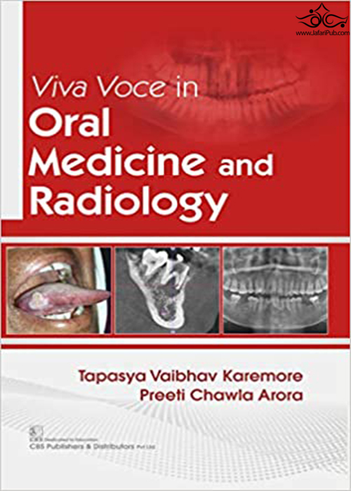 Viva Voce Oral Medicine and Radiology CBS Publishers & Distributors