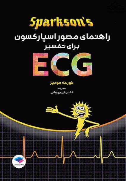 راهنمای مصور اسپارکسون برای تفسیر ECG