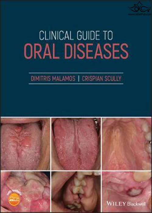 Clinical Guide to Oral Diseases  John Wiley and Sons Ltd 