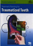 Treatment Planning for Traumatized Teeth | برنامه ریزی درمان برای دندان های آسیب دیده