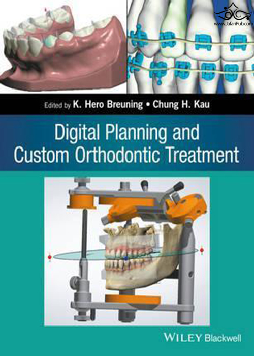 Digital Planning and Custom Orthodontic Treatment  John Wiley and Sons Ltd 