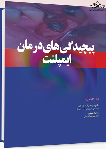 پیچیدگی های درمانی ایمپلنت