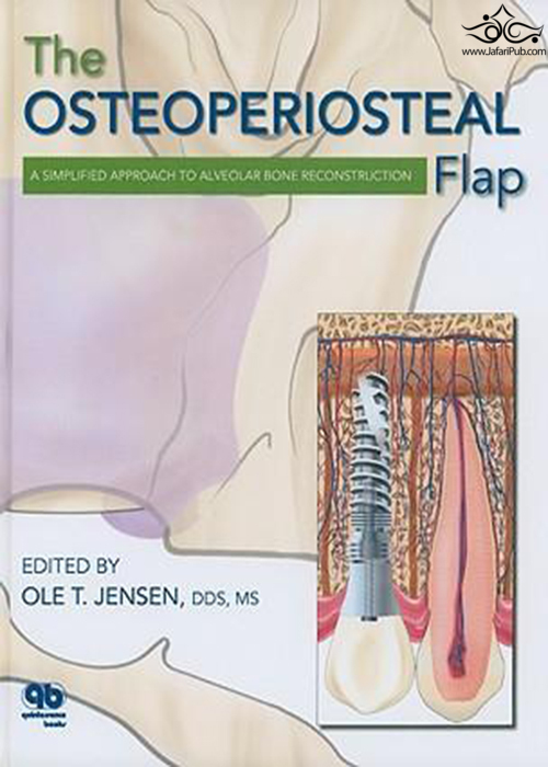 The Osteoperiosteal Flap : A Simplified Approach to Alveolar Bone Reconstruction  Quintessence Publishing Co Inc.,U.S