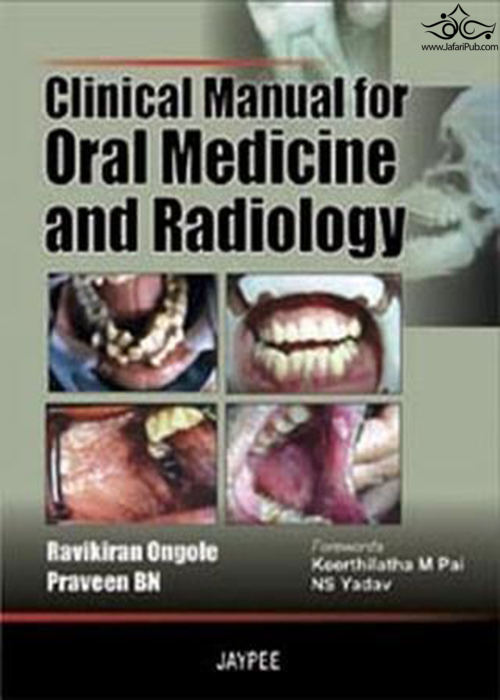 Clinical Manual for Oral Medicine and Radiology  Jaypee Brothers Medical Publishers 