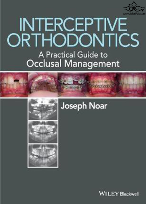 Interceptive Orthodontics : A Practical Guide to Occlusal Management John Wiley-Sons Inc