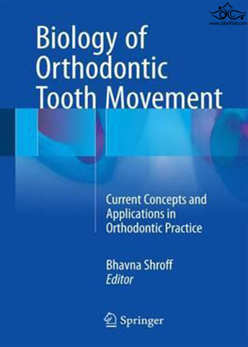Biology of Orthodontic Tooth Movement : Current Concepts and Applications in Orthodontic Practice Springer