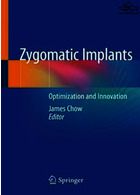 Zygomatic Implants : Optimization and Innovation | کتاب ایمپلنت های زیگوماتیک