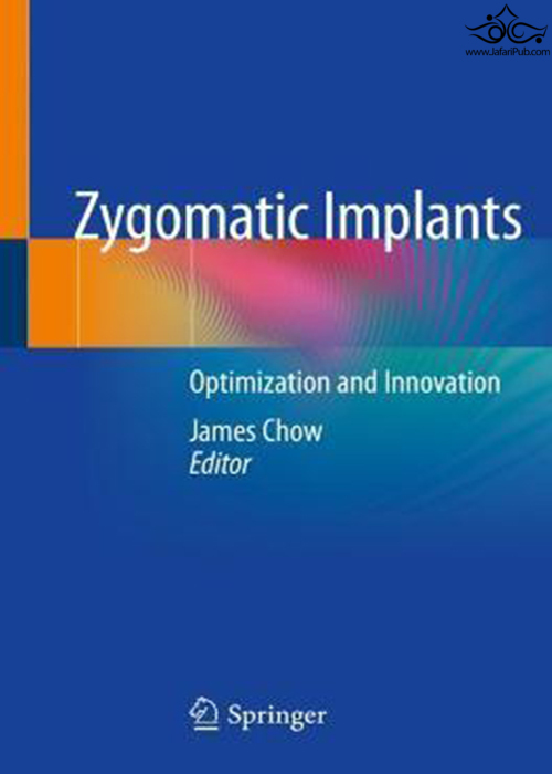 Zygomatic Implants : Optimization and Innovation Springer