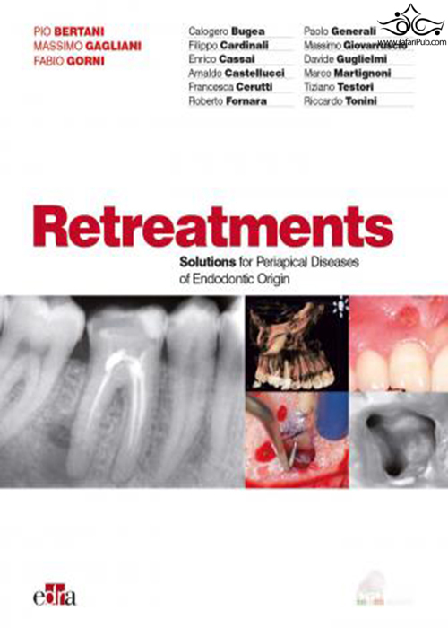 Retreatment. Solutions for apical diseases of endodontic origin  Edra Spa 