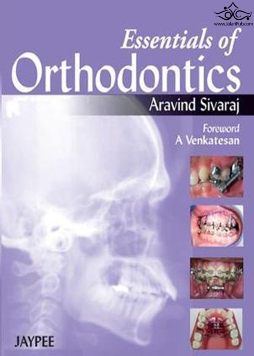 Essentials of Orthodontics 2013  Jaypee Brothers Medical Publishers 