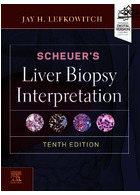 Scheuer's Liver Biopsy Interpretation | تفسیر بیوپسی کبد شوئر