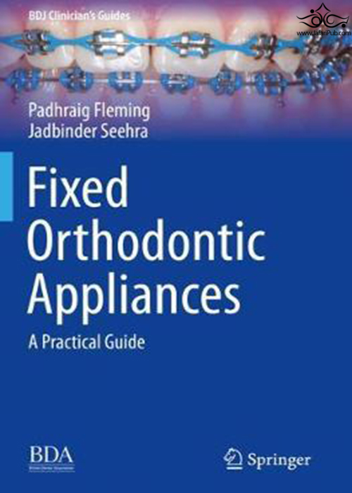 Fixed Orthodontic Appliances : A Practical Guide Springer