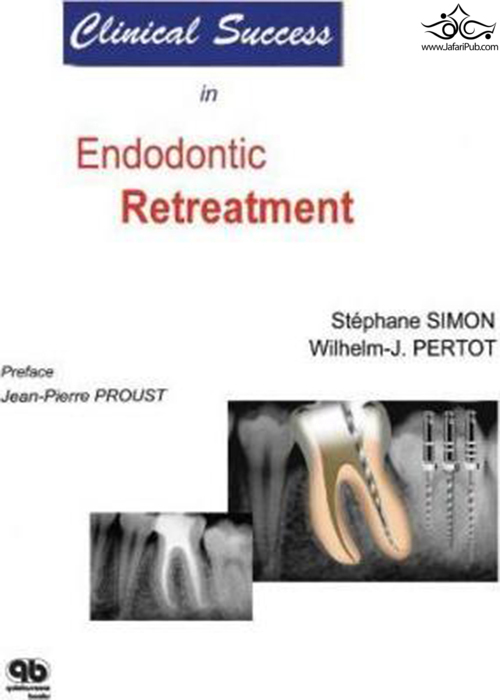 Clinical Success in Endodontic Retreatment  Quintessence Publishing Co Inc.,U.S