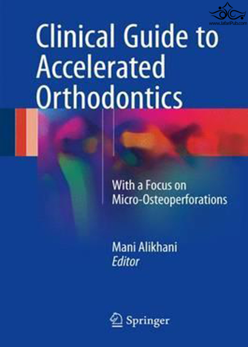 Clinical Guide to Accelerated Orthodontics : With a Focus on Micro-Osteoperforations Springer